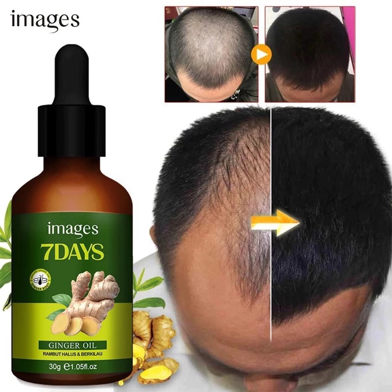 Cindynal Ginger Oil Clothes of Skin 7 days Minyak Penumbuh Rambut Botak Rontok Pria Anak Bayi Balita
