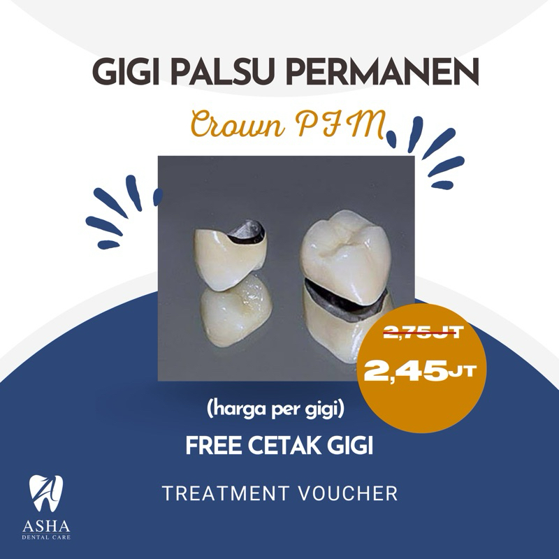 Gigi Palsu Permanen PFM