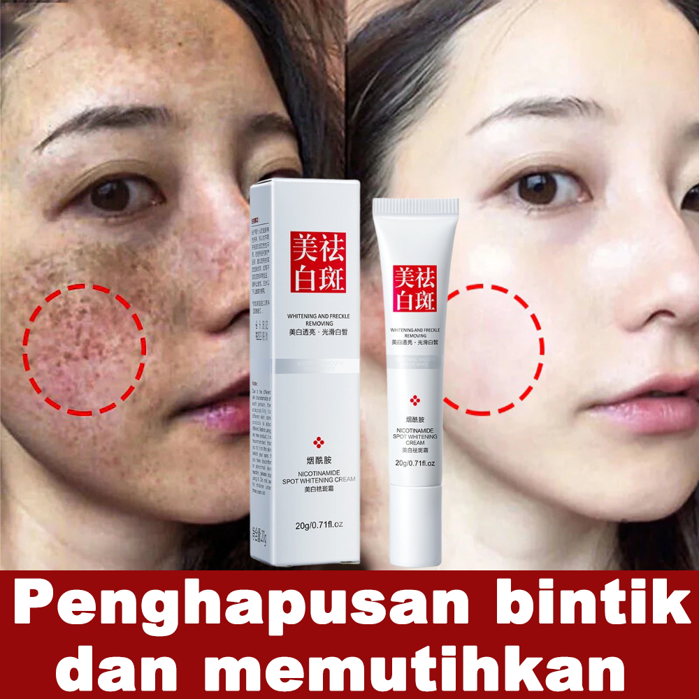 Krim pemutih wajah flek hitam cream penghilang flek hitam salep melasma 20g niacinamide cream hapus 