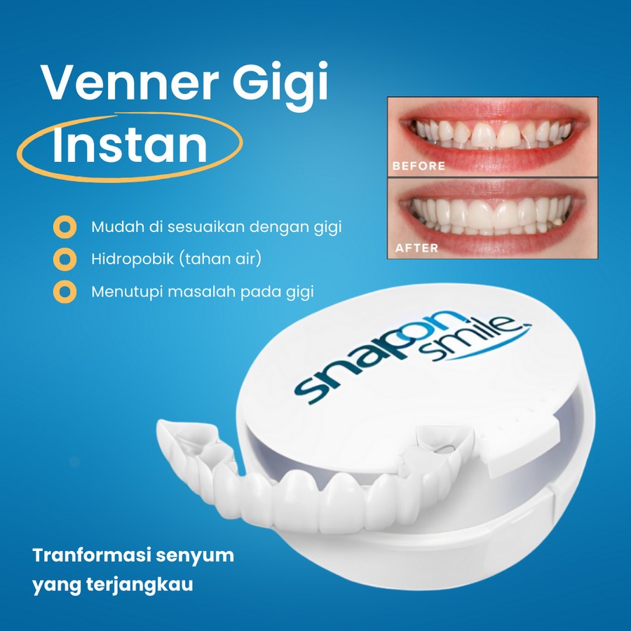 Veneer Snap On Smile Gigi Palsu instan Atas Bawah