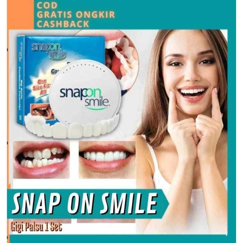 SNAP ON SMILE SATU SET ATAS BAWAH ORIGINAL 100% (yiwumotor) GIGI PALSU