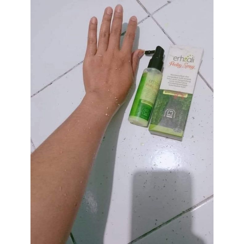 Ershali peeling spray Nasa, Peeling spray perontok dakii