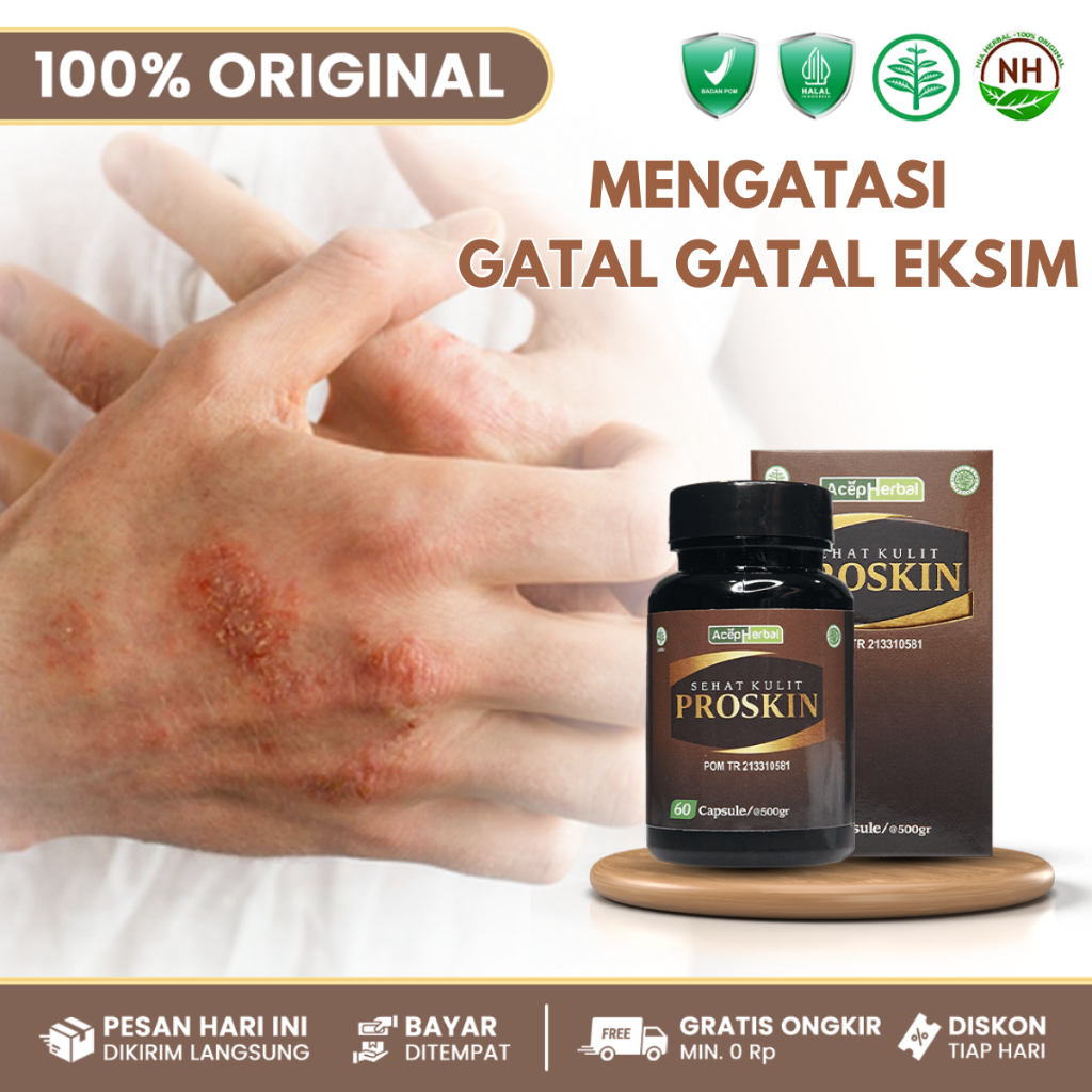 Proskin 100% Asli 60 Kapsul - Obat Gatal Gatal - Obat Eksim Atau Dermatitis - Obat Eksim - Obat Panu