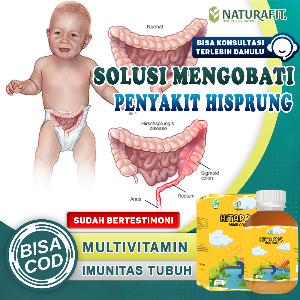Obat Hispung Anak Bayi Balita Paling Ampuh Penyakit Hirschsprung Gangguan Usus Besar Perut Bengkak K