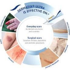 AZO1 Dermatix Ultra 15gr 100% Original