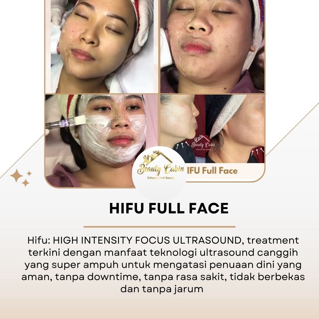 PROMO COUPLE HIFU FULL FACE