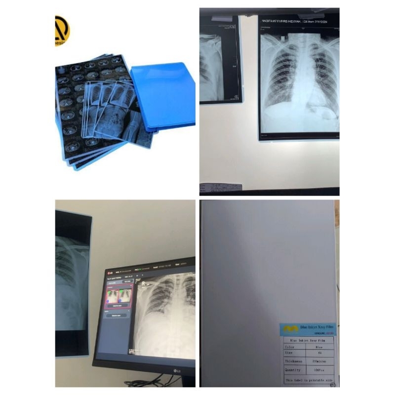 Medical Blue film injet A4