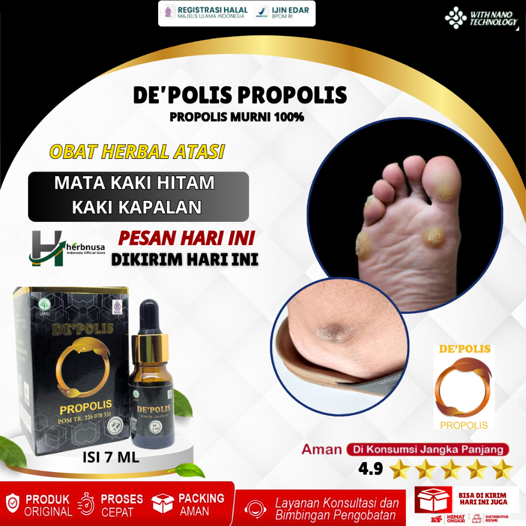 Obat Mata Kaki Hitam Kaki Kapalan Kaki Pecah Pecah Dan Kering Mata Kaki Bengkak Kering Hitam Mata Ik