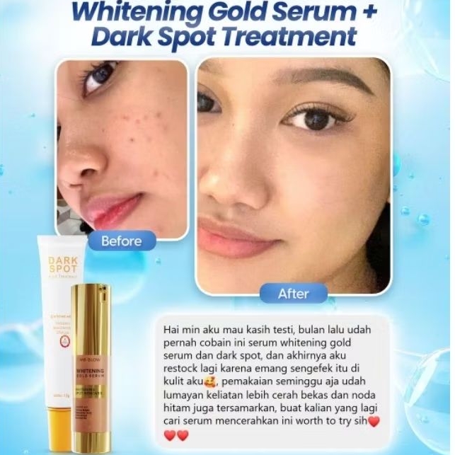 Paket Serum Flek MS glow - Gold serum + dark spot serum