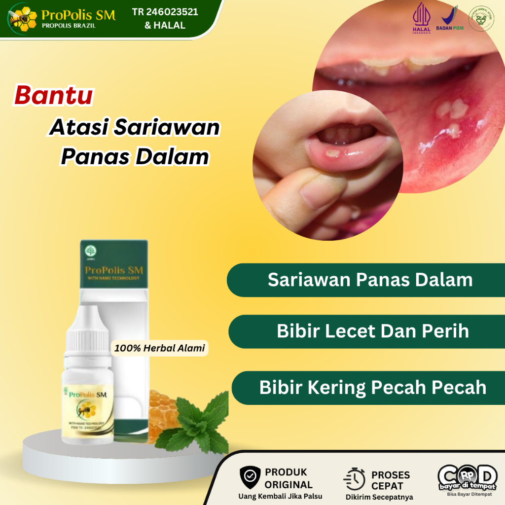 Obat Sariawan, Panas Dalam, Bibir Kering Pecah Pecah, Menghilangkan Sariawan, Sariawan Di Bibir, Bib