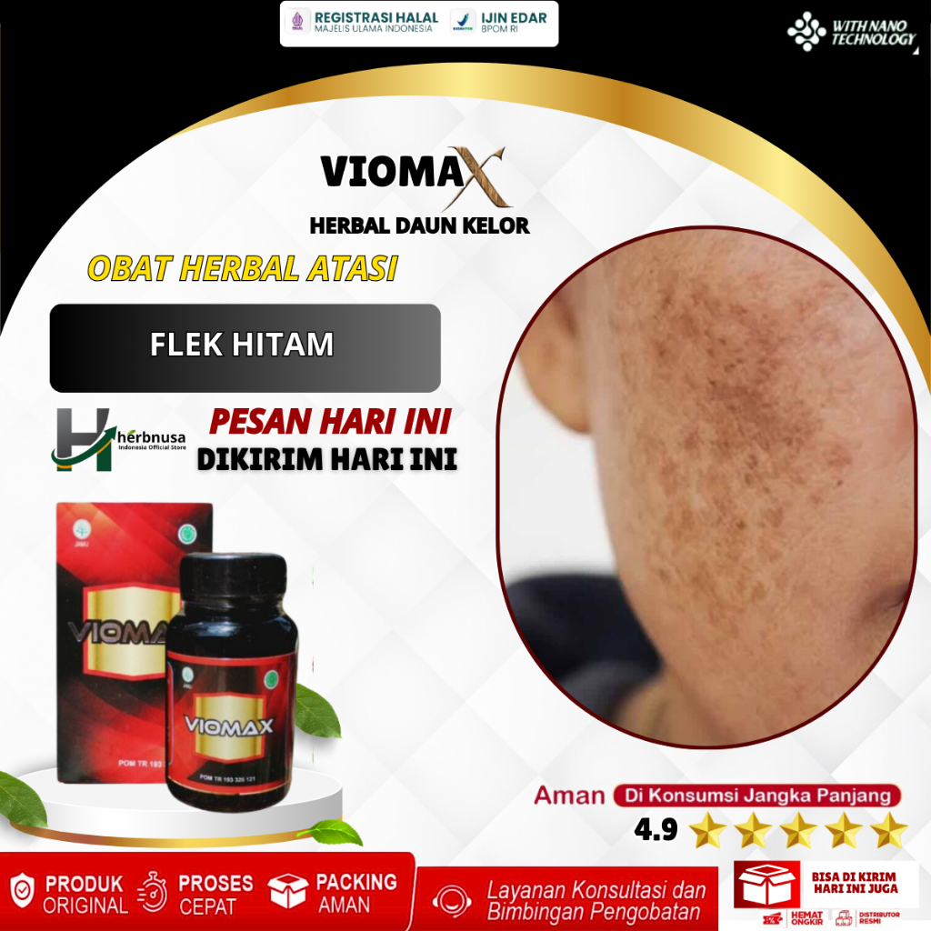 Obat Flek Hitam - Penghilang Flek Hitam Alami, Pemudar Flek Hitam di Wajah Hidung dan Pipi, Obat Men