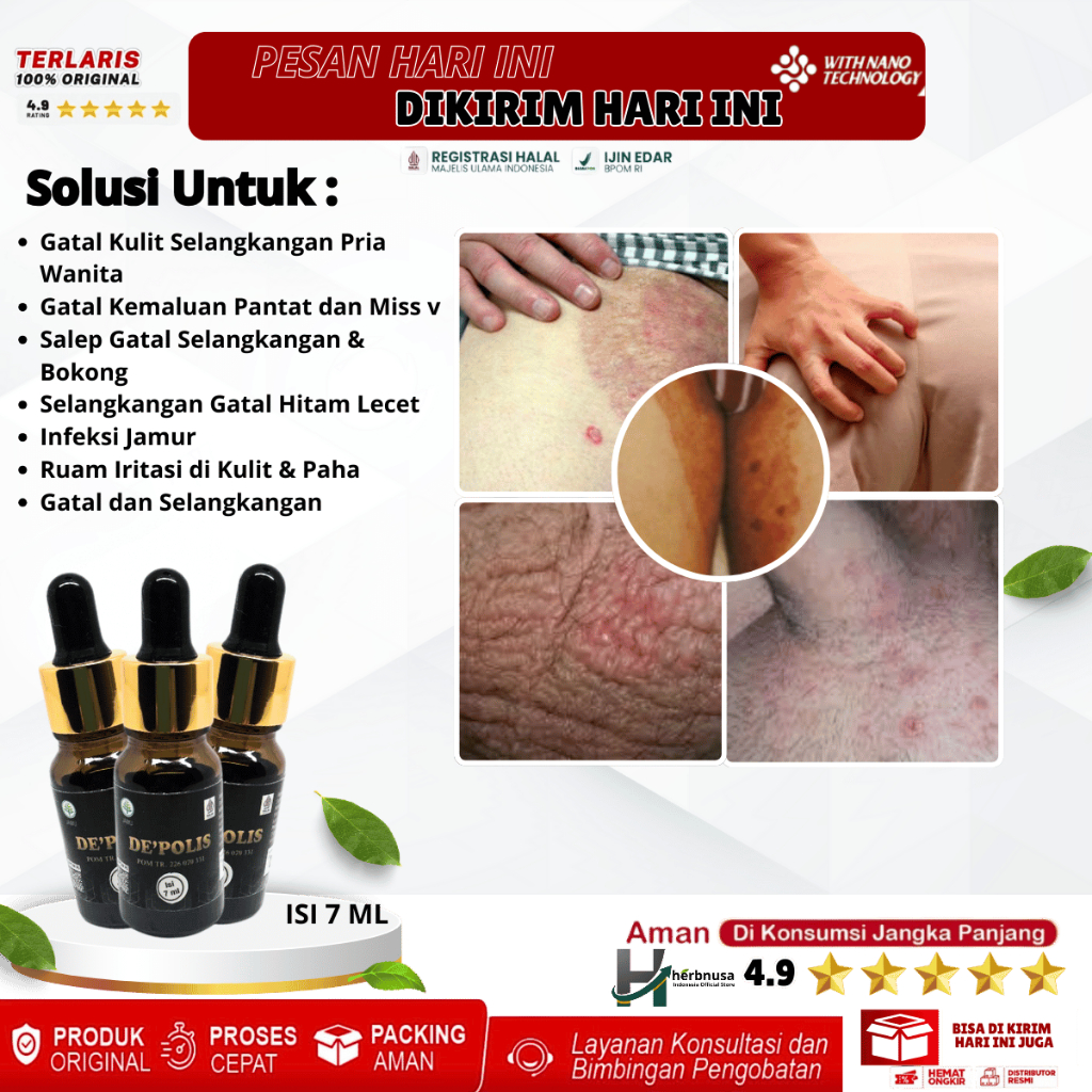 Obat Gatal Kulit Selangkangan Pria Wanita, Gatal Kemaluan Pantat dan Miss v, Salep Gatal Selangkanga