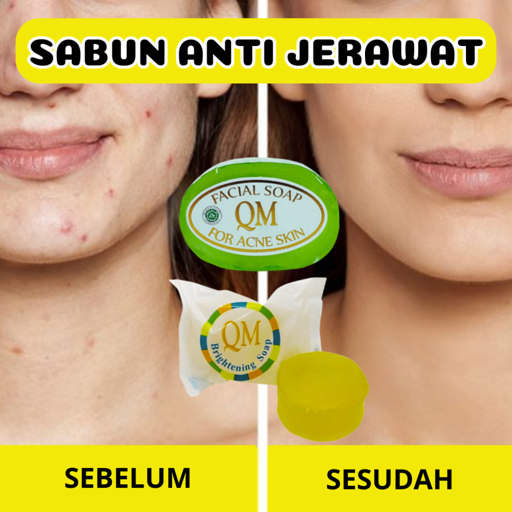 Sabun QM BPOM Anti Acne -Sabun Ampuh Menghilangkan Jerawat dan Bekas Jerawat / Flek - QM Soap Acne /