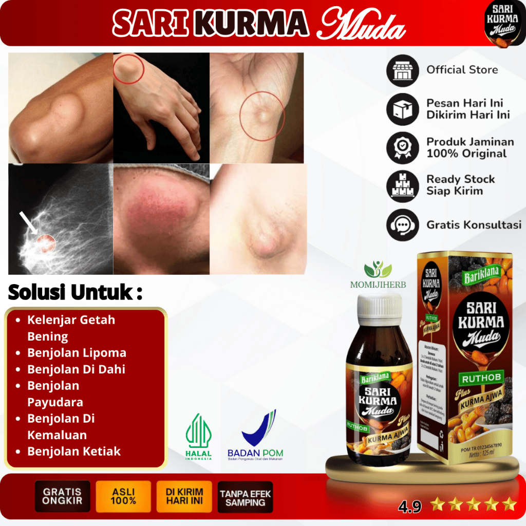 Obat Kelenjar Getah Bening, Benjolan Lipoma, Benjolan Di Dahi, Benjolan Payudara, Benjolan Di Kemalu