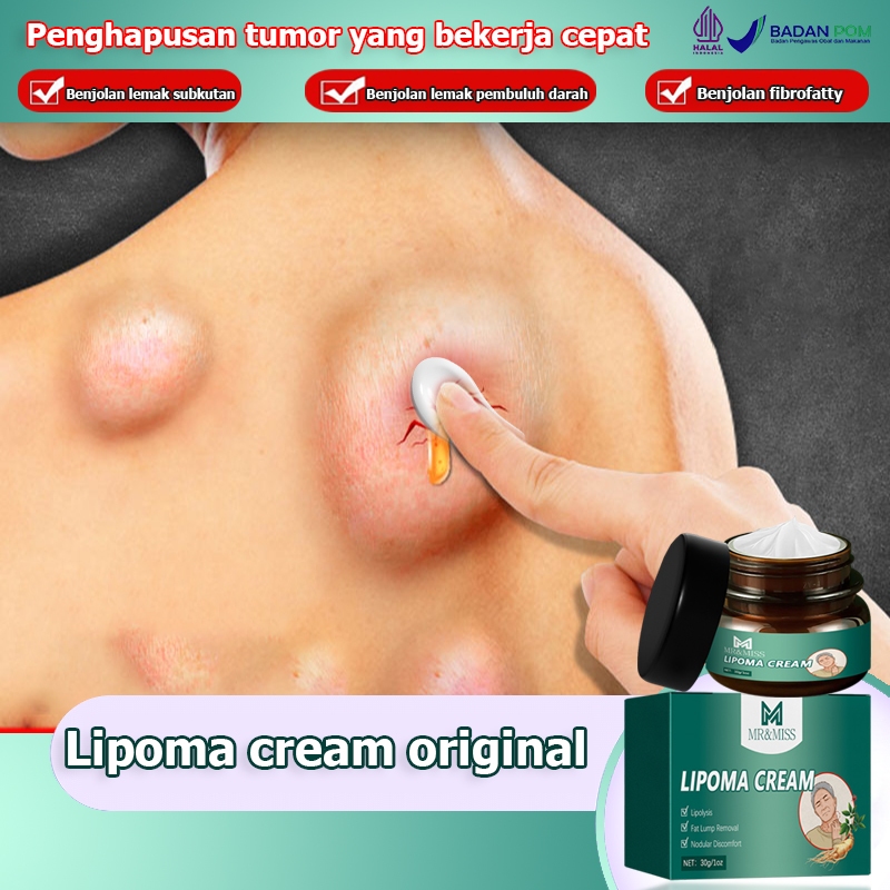 Lipoma cream original Obat benjolan Lipoma removal cream original Obat lipoma Salep lipoma salep ben