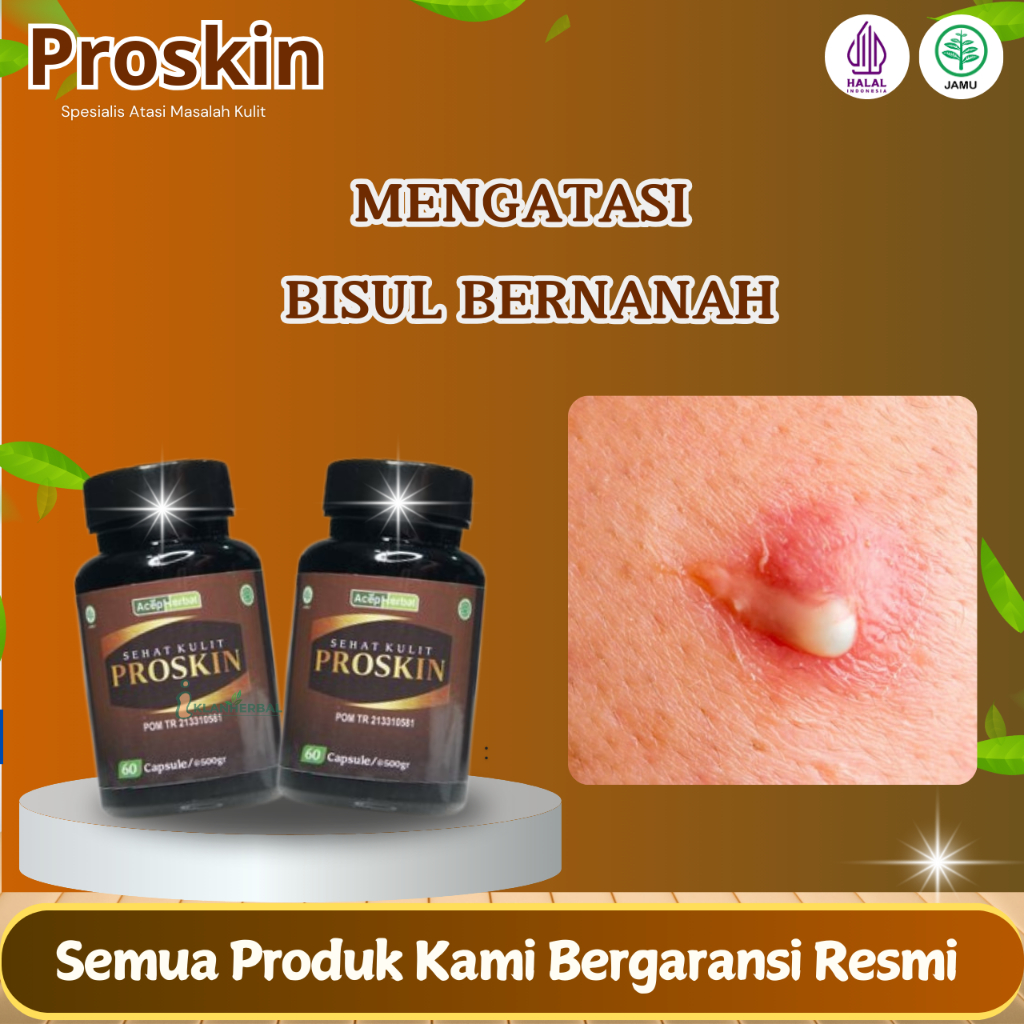 Obat Bisul Bernanah Bisul Berdarah  Bisul Di Pantat Bisul Di Ketiak Cenang Di Tangan Dengan Proskin