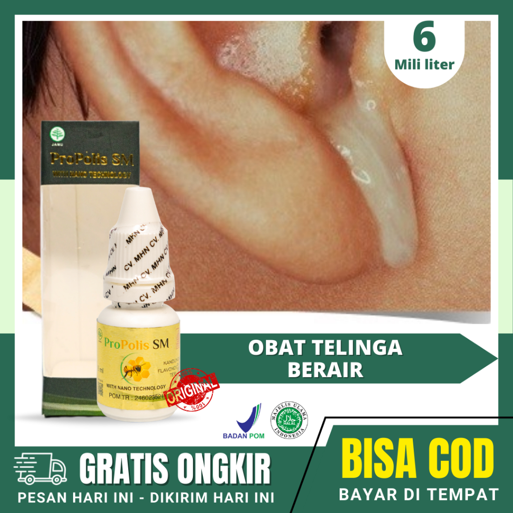 Obat Tetes Telinga Berair dan Bau, Telinga Bernanah, Telinga Berdengung Budeg, Propolis SM