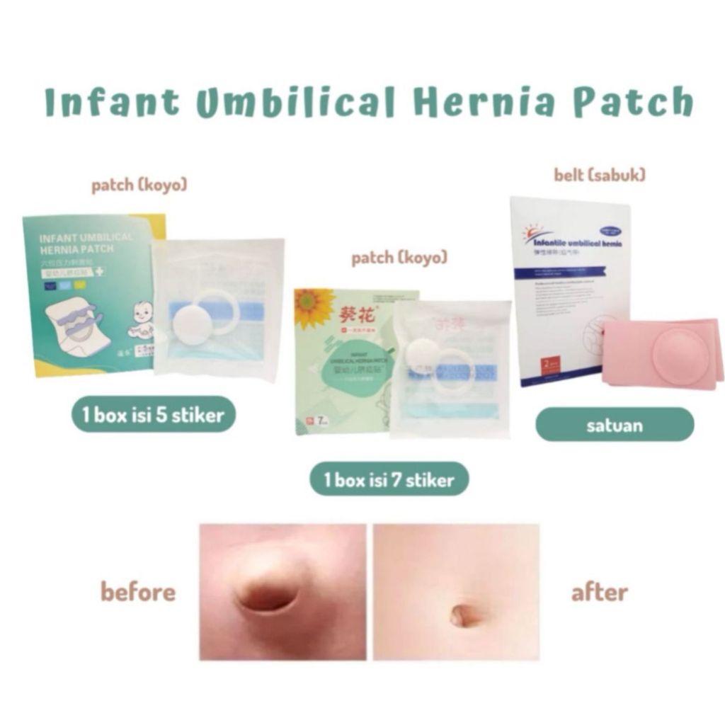 STIKER HERNIA ANAK / koyo hernia / koyo PUSAR BODONG / Infant Umbilical HERNIA Patch / Stiker Hernia
