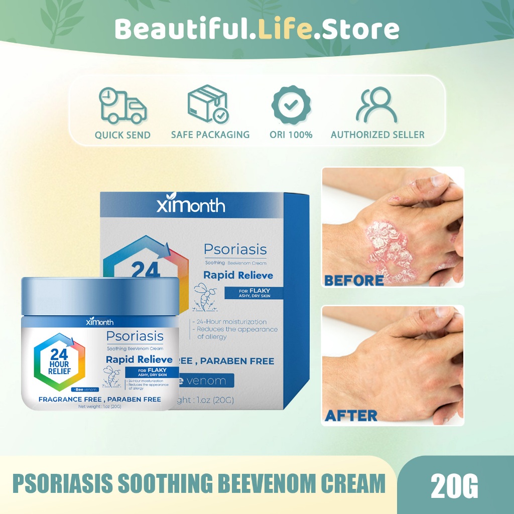 Ximonth【100%ORI/Beli 4 Gratis 3】Psoriasis Soothing Beevenom Cream 20g Psoriasis Cream Eczema Cream K