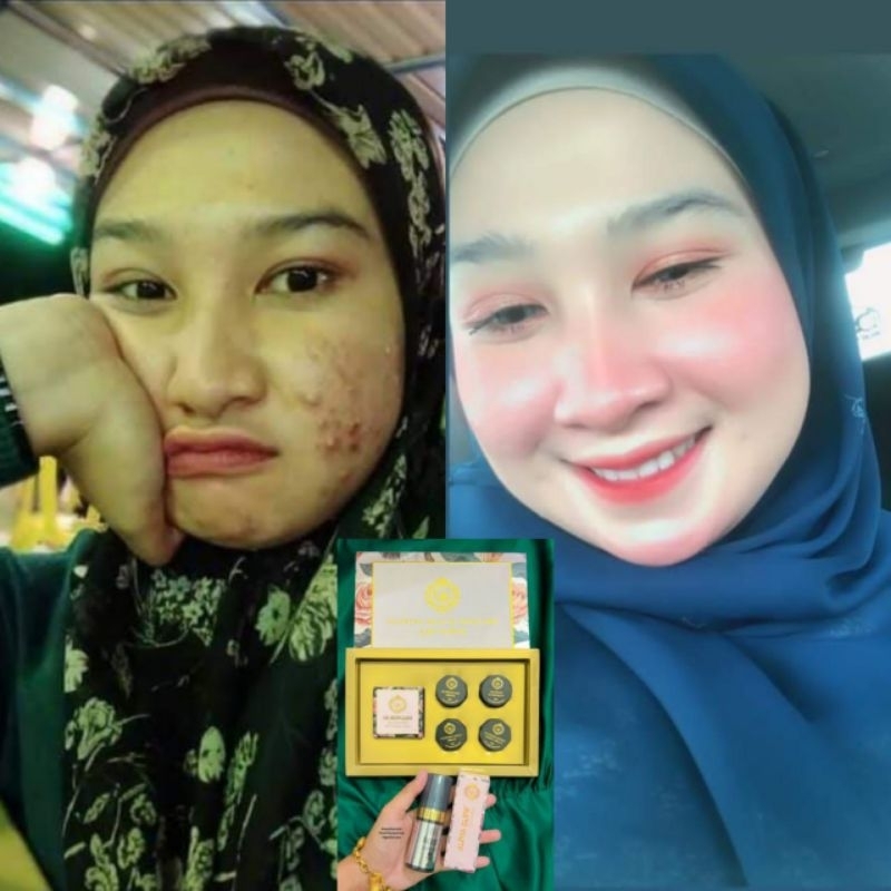 GB SKINCARE MALAYSIA