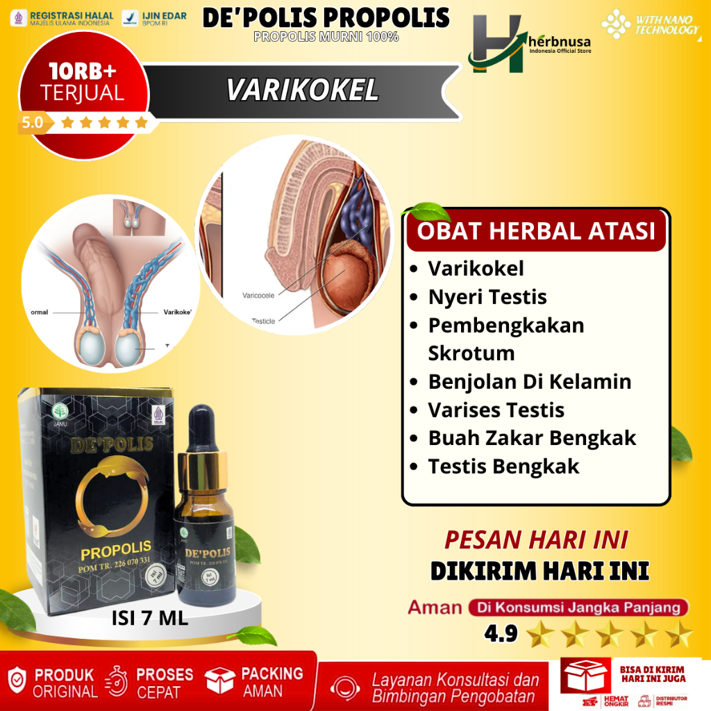 Obat Varikokel Pembengkakan Pada Pembuluh Darah Vena Serangan Jantung Alami Nyeri Testis Pembengkaka