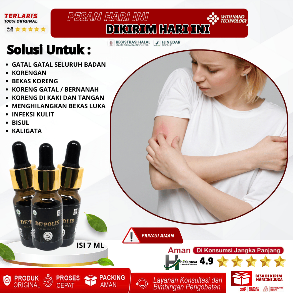 Obat Gatal Gatal Seluruh Badan, Korengan, Penghilang Koreng, Bekas Koreng, Koreng Gatal, Koreng Bern