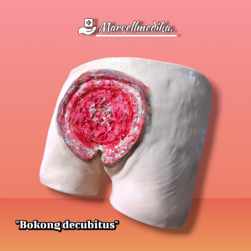 PHANTOM MANEKIN BOKONG DECUBITUS / MANIKIN PERAGA BOKONG LUKA DECUBITUS