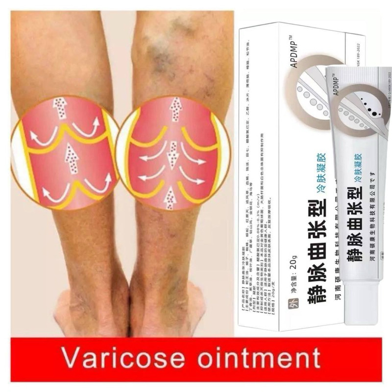 OBAT SALEP VARISES HERBAL