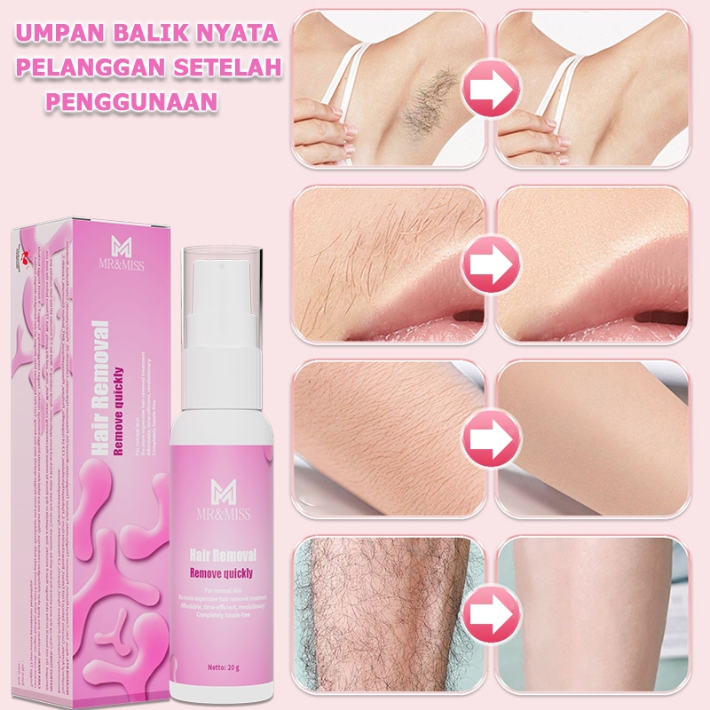 Perontok bulu kemaluan perontok bulu permanen cukuran bulu kemaluan perontok bulu ketiak 20ml