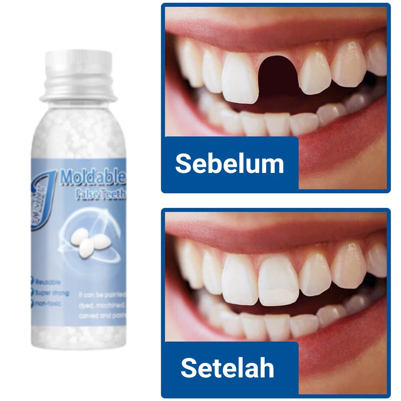 Gigi Palsu Temptooth Original Penambal Gigi Berlubang Gigi palsu Asli Dokter permanen Tambalan gigi 