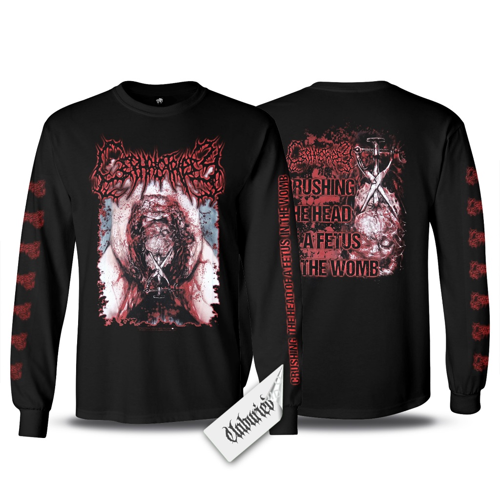 Long Sleeve - Cephalotripsy - Crushing the Head of a Fetus in the Womb