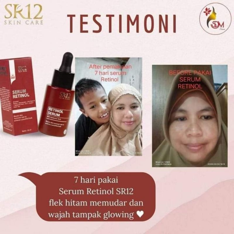 Retinol serum SR12 skincare