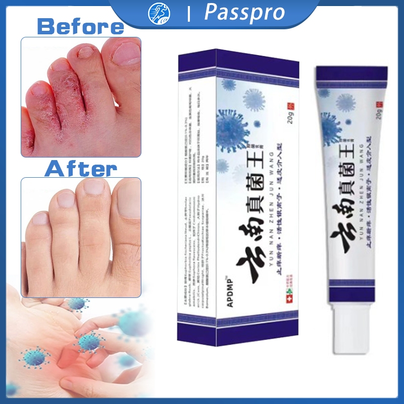 Obat Kaki Rayapan Dan Bau Obat Kaki Rayapan Penghilang Bau Kaki Obat Kaki Rayapan Paling Salep