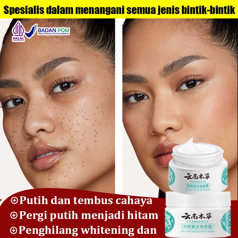 Whitening Blemish Flek Hitam Penghilang Flek Hitam Original Magic Glow Cream Anti Freckle Salep Mela