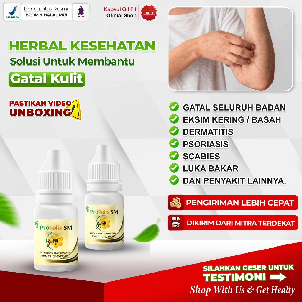 Obat Gatal Kulit Alergi Dingin Biduran Gatal Alergi Herbal Bentol Kulit, Obat Biduran Kronis, Alergi