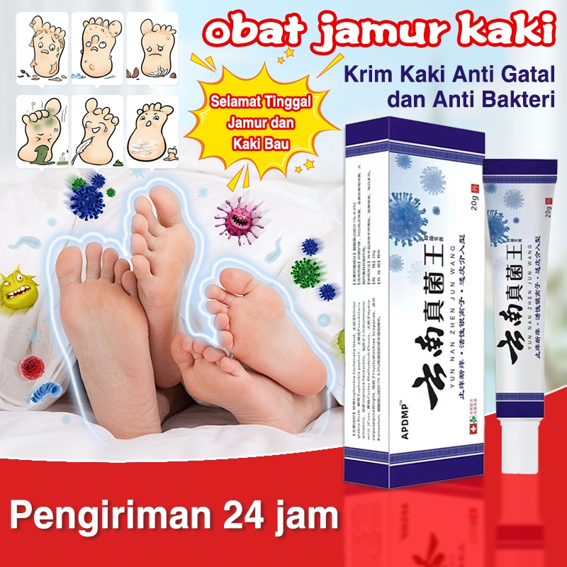 Yunnan efek khusus krim gatal 20g krim eksim krim antijamur pengobatan psoriasis krim gatal pangkal 