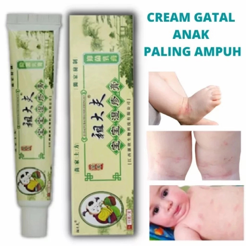 Salep Anak-Anak Balita Bayi Salep Kulit Gatal Paling Ampuh Salep Kulit Eksim Gatal Selangkangan Aler