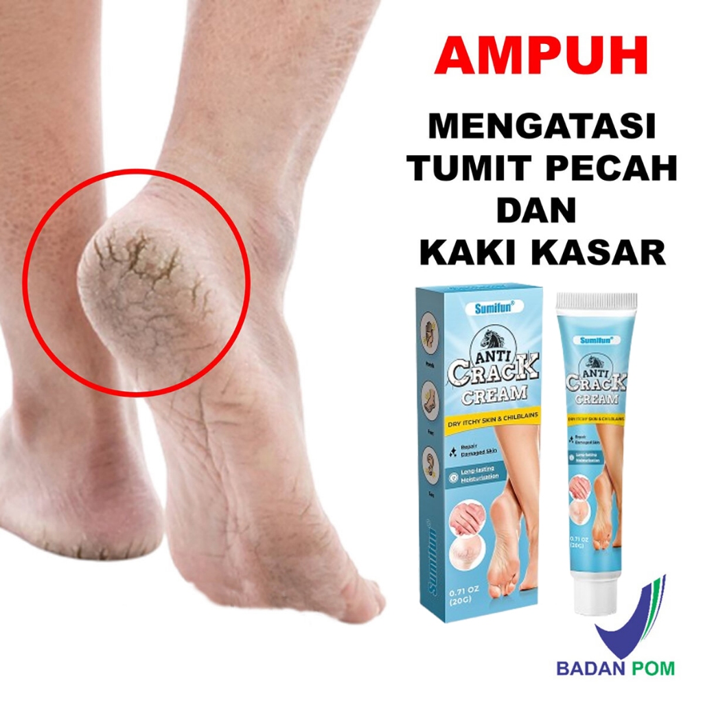 Obat Kaki Pecah dan Kering Ampuh Foot & Heel Cream Perawatan Penghalus Telapak Mengatasi Tumit Kapal