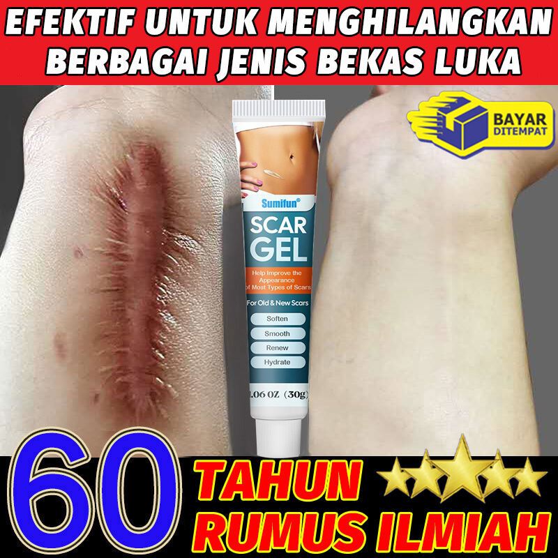 salep bekas luka Ampuh dermatik salep penghilang bekas luka ori/obat penghilang bekas luka koreng hi