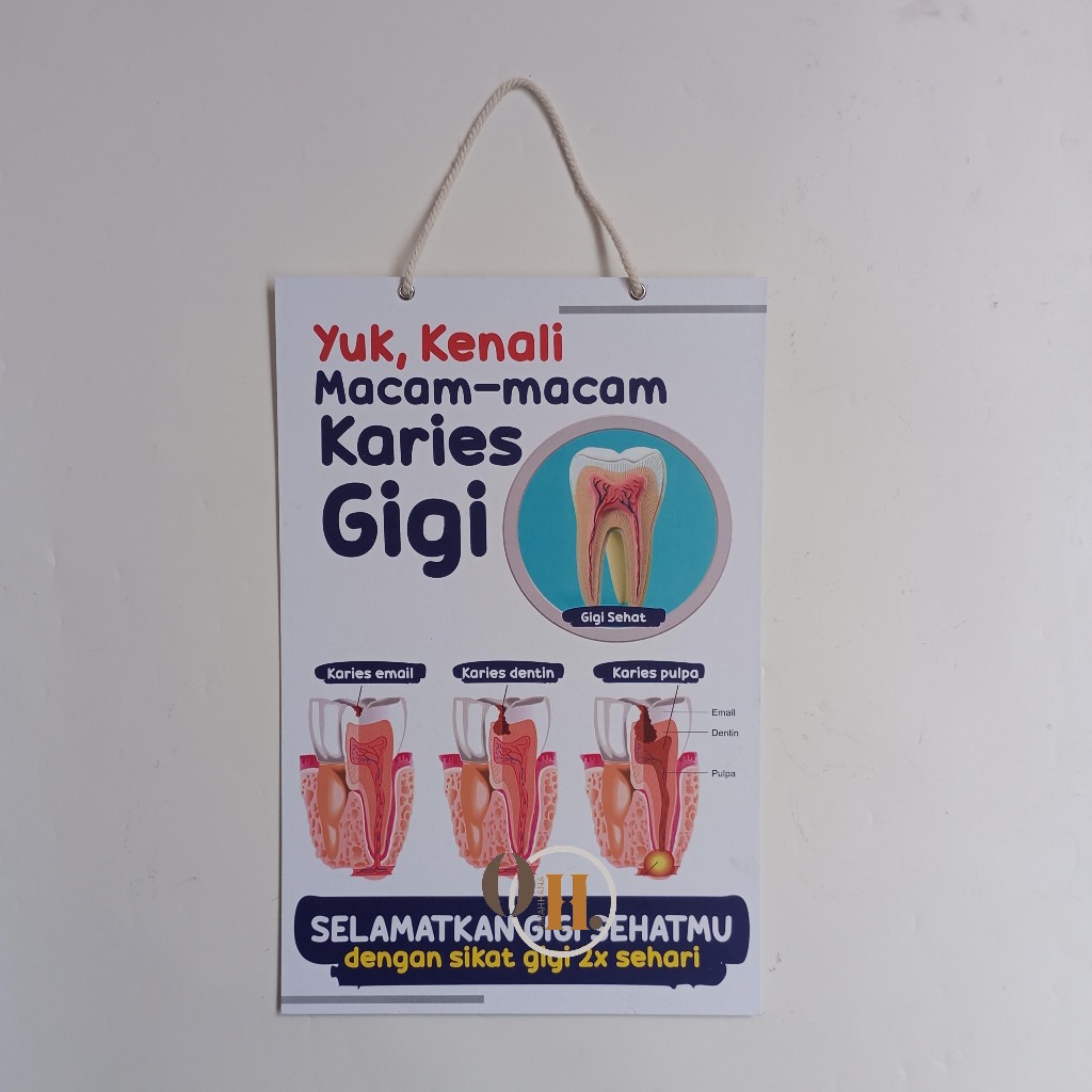

Hard Poster Kenali Macam-Macam Karies Gigi - Kesgilut - Kesehatan - Karies Gigi