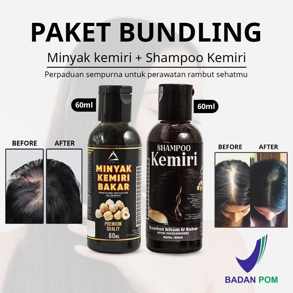 Paket 2in1 Shampoo & Minyak Kemiri Penumbuh Rambut Cepat Penghilang Uban Dan Rontok 60ml - BPOM