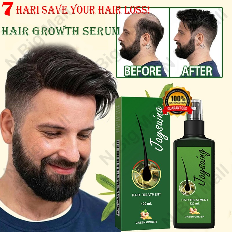 Hair Tonic spray Penumbuh rambut botak Perawatan Rambut Penumbuh rambut cepat spray Perawatan rambut