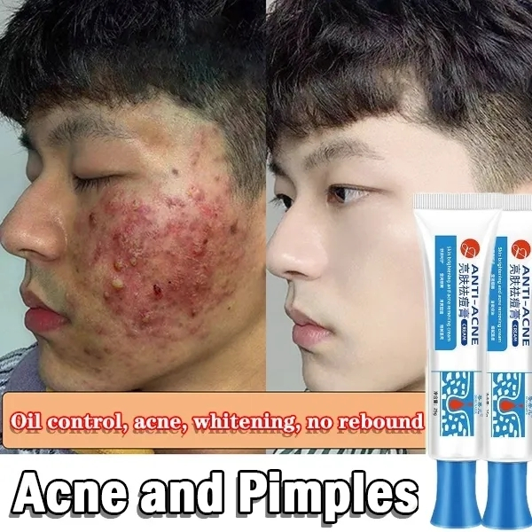 Krim Jerawat Salep Jerawat Krim Jerawat Centella Asiatica 25g Obat Penghilang Jerawat dan Bekas Jera