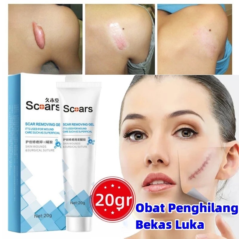Obat Penghilang bekas luka hitam koreng Penghilang bekas gigitan nyamuk bekas luka Jerawat