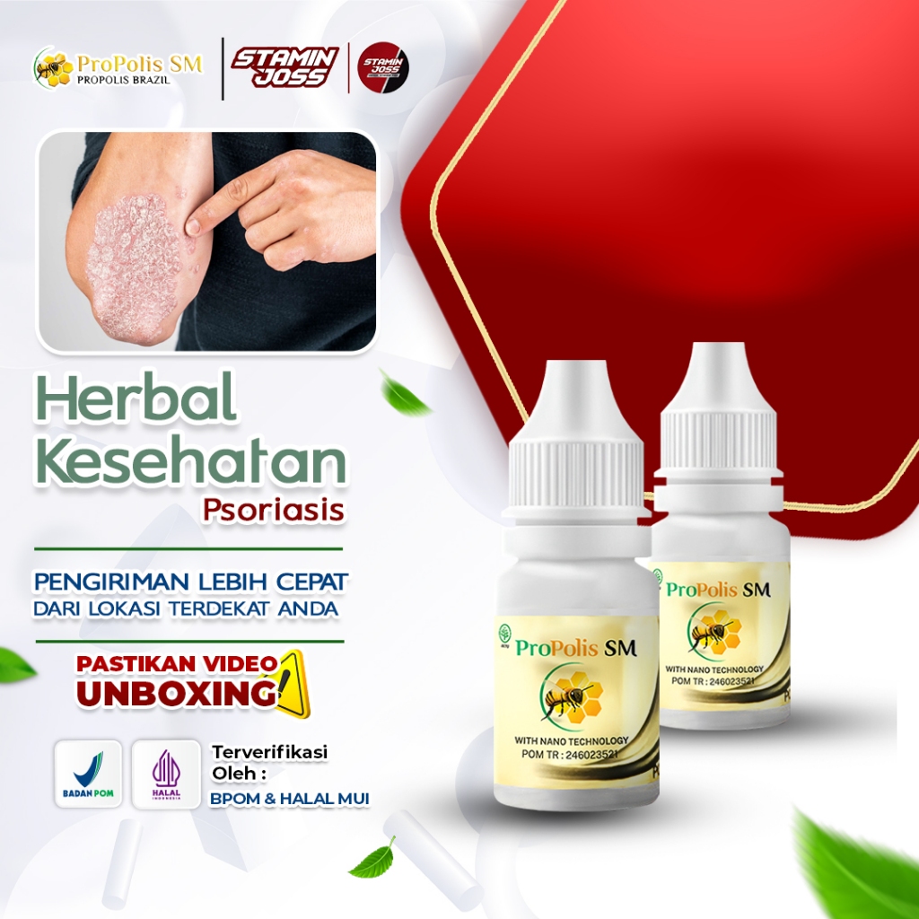 Obat Psoriasis Kulit Gatal Gatal Seluruh Badan Ruam Merah Kulit Tebal Bersisik Bengkak Eksim kering 