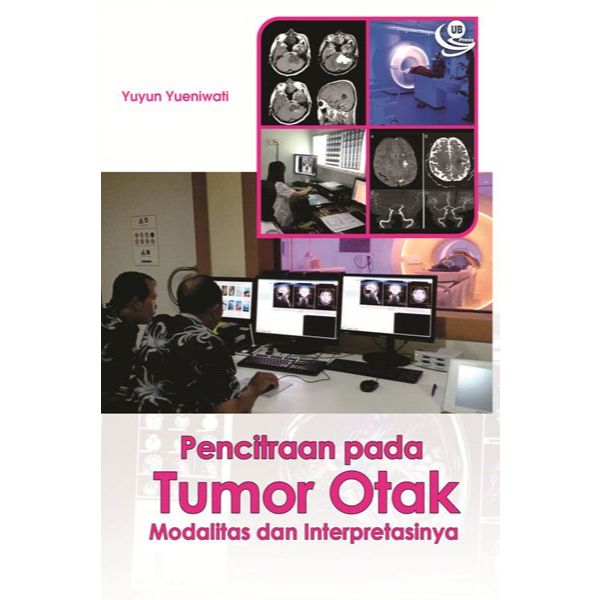 Pencitraan pada Tumor Otak