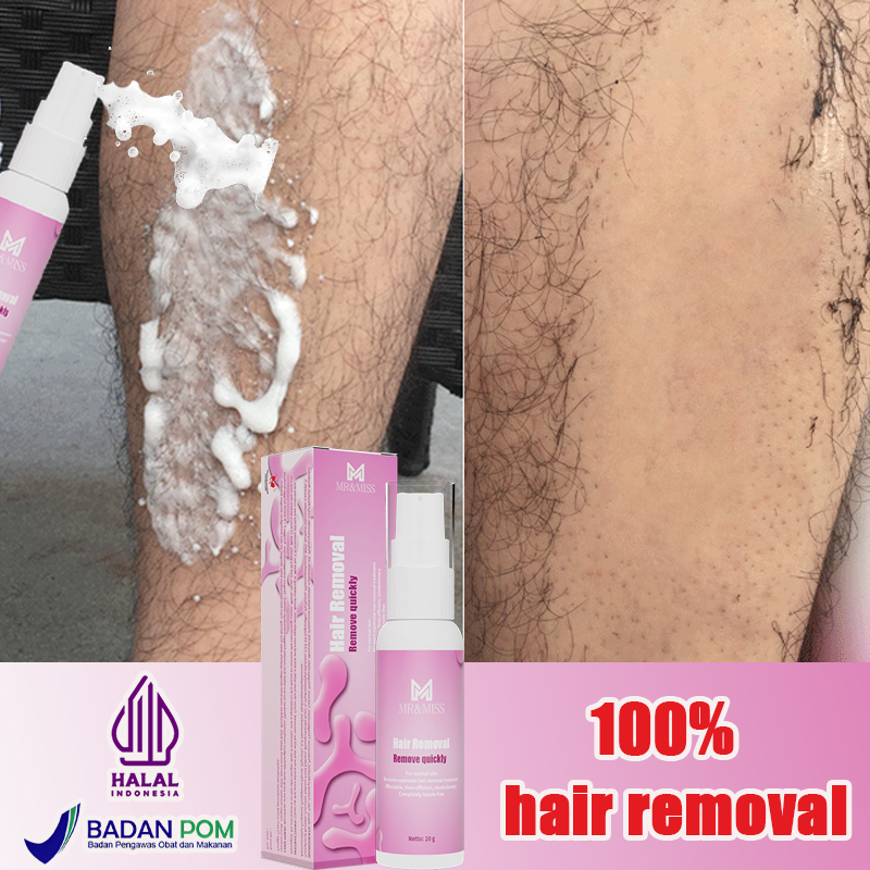 Perontok bulu miss v permanen bpom hair removal cream perontok bulu permanen 20g Krim penghilang bul