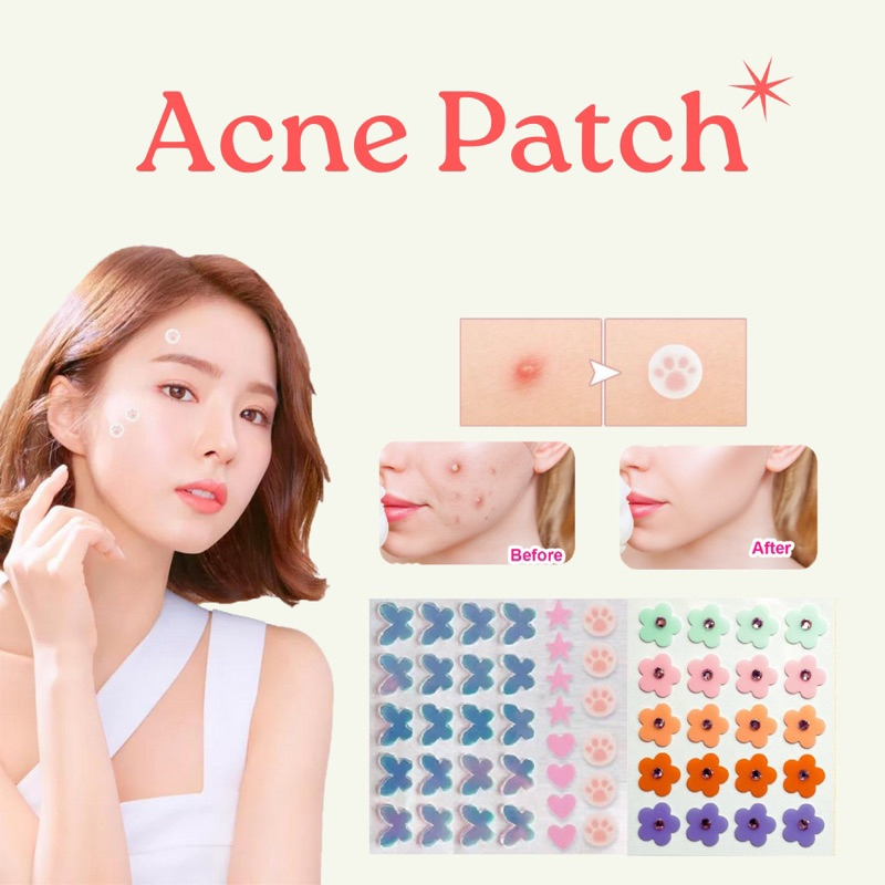 ACNE PATCH Patch jerawat cute acne Patch acne Patch lucu