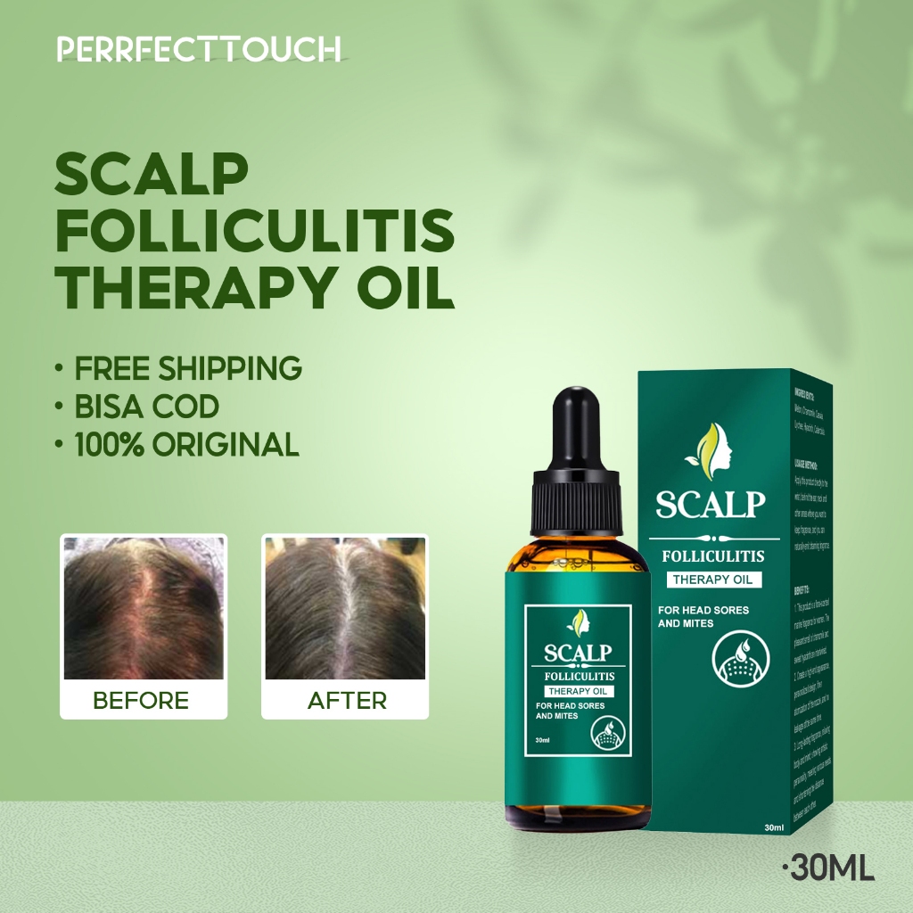 EELHOE Scalp Folliculitis Therapy Oil 30ml Obat Kulit Kepala Penumbuh Rambut Obat Ketombe Dan Rontok