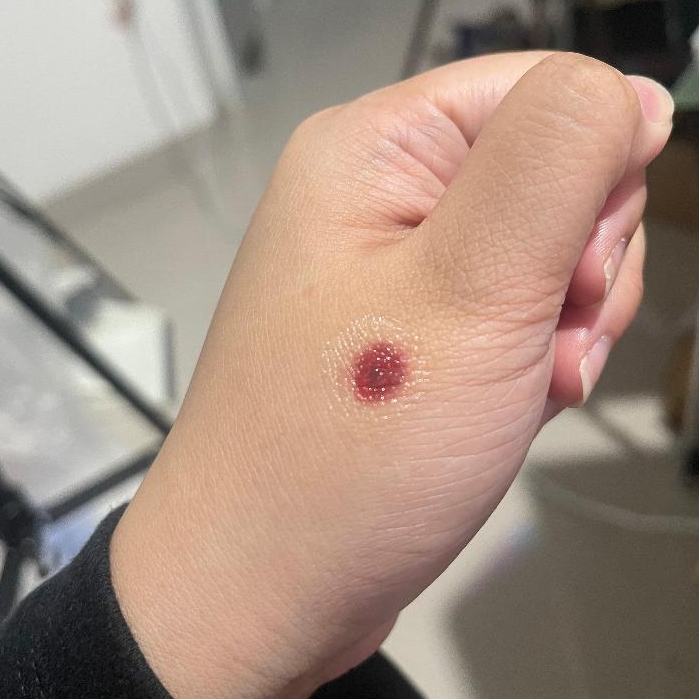 LUKA SUNDUT TEMPORER TATTOO | Puncture wound | Cigar Burn | SFX TATTOO | COSPLAY TATTOO | LUKA PALSU